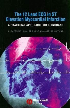 The 12 Lead ECG in ST Elevation Myocardial Infarction: Buy The 12 Lead ...