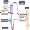 Explain the principle of dialysis with the help of a labeled diagram ...