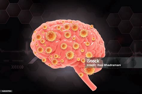 Image result for Brain Computer Virus