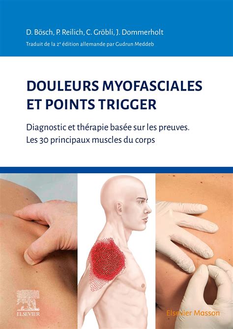 Buy Douleurs myofasciales et points trigger: Diagnostic et thérapie ...