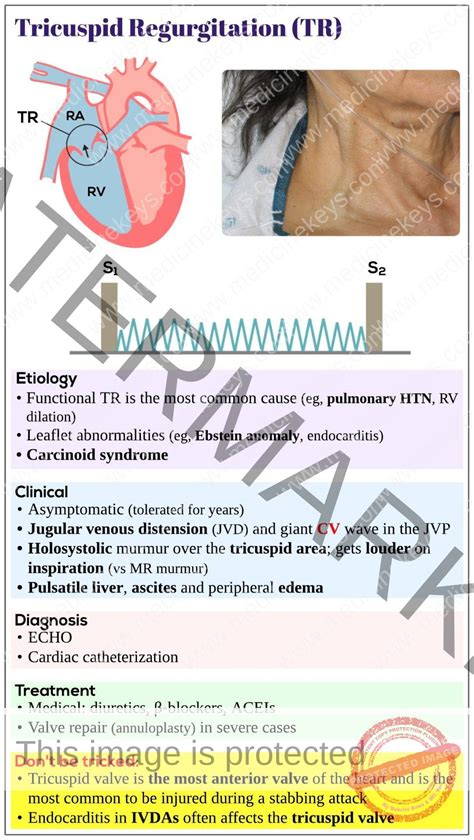 What Is Tr In Medicine at Ella Dierking blog