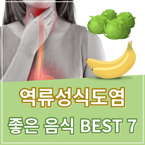 속쓰림 탈출! 역류성식도염 좋은 음식을 알아보자 - Jjye's learning Blog