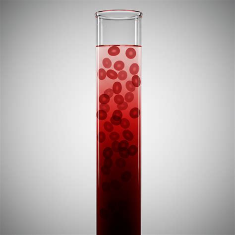 VELOCIDAD DE SEDIMENTACION GLOBULAR (VSG) – Omedic