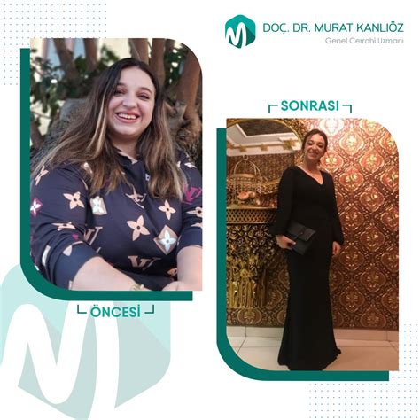 Pilor Revizyonu Fiyatları 2025 | Doç. Dr. Murat Kanlıöz Antalya