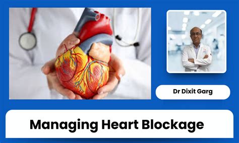 Clearing the Heart: 4 Things Your Doctor May Suggest for a Heart ...