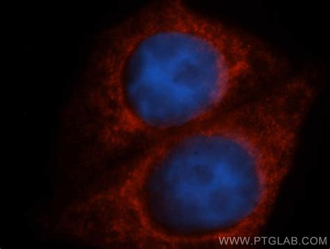 TAB2 antibody (14410-1-AP) | Proteintech