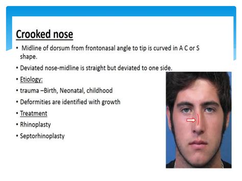 Diseases of nose and paranasal sinuses.pdf