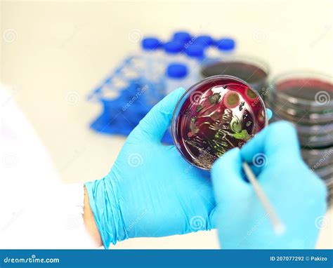 Scientist Analysis Escherichia Coli E.coli Culture with Eosin Methylene ...