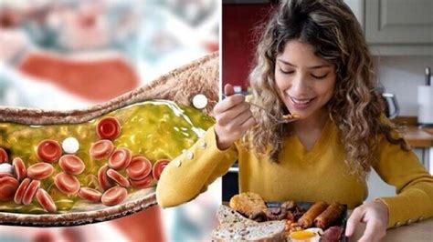 हाई कोलेस्ट्रॉल से हैं परेशान तो बंद कर दीजिए ये चीजें खाना, नहीं जमेगा ...