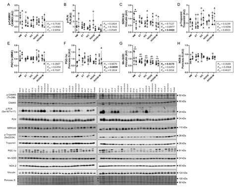 In Vitro Embryo Culture Impacts Heart Mitochondria in Male Adolescent Sheep