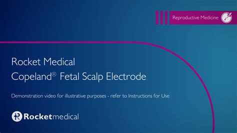 Rocket Medical Copeland(R) Fetal Scalp Electrode on Vimeo