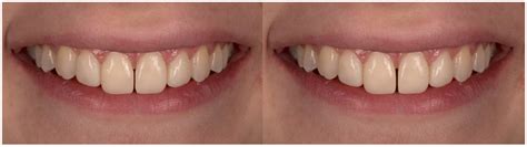 The Influence of Social Network Content on the Perception of Smiles—A ...