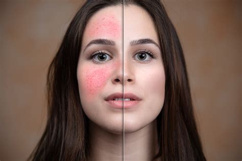 Finding Balance: Tips for Managing Combination Skin – Saturn by GHC