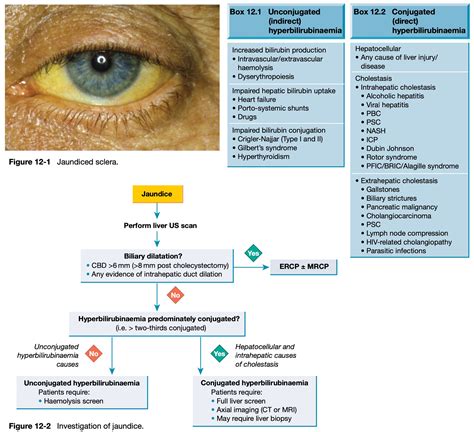 Approach to Jaundice