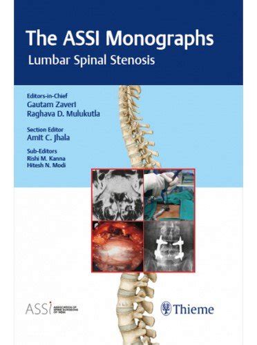 Buy The ASSI Monographs-Lumbar Spinal Stenosis Book Online at Low ...