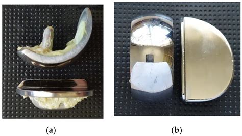 Wear Morphology on the Surfaces of CoCrMo Unicompartmental Knee Joint ...