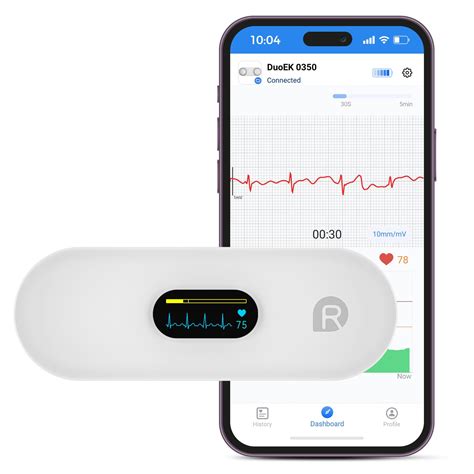 Amazon.com : OVIIN Portable Heart Rate Monitor, Wireless Home Use Heart Rhythm Tracker, Heart ...