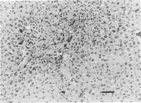 Image result for Intraperitoneal Inoculation Mouse