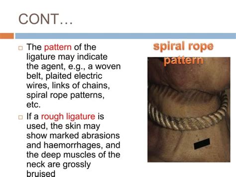 Image result for Strangulation Compression