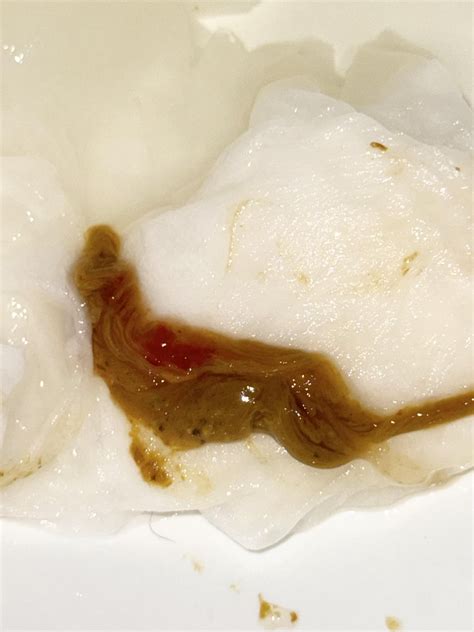 Mucus with a small amount of blood : r/poop