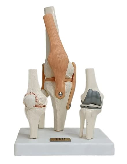 Kay Kay Industries Premium Knee Joint Model Set (Normal Life Size Knee ...