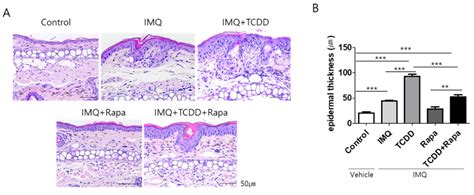 Rapamycin Alleviates 2,3,7,8-Tetrachlorodibenzo-p-dioxin-Induced ...