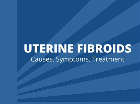 Fibroids: Causes, Symptoms, And Treatment – Rededit Magazine
