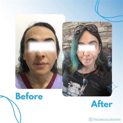 Best Gender Reassignment / Affirmation Surgery in Mumbai