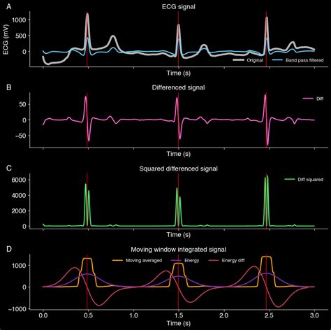 Image result for Beat Detection Algorithm