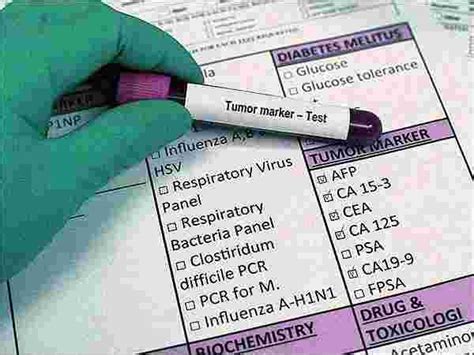 Best Cancer Marker Tests - Blood Test & Path Labs in Chennai, Top ...
