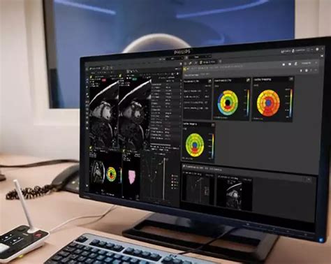 Diagnostic and clinical informatics - Philips