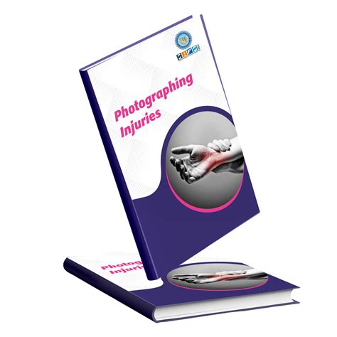 Photographing Injuries Suggestions