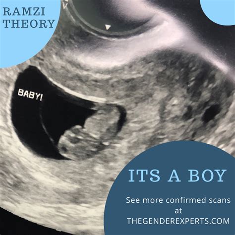 baby at 14 weeks ultrasound gender - Leslee Arndt