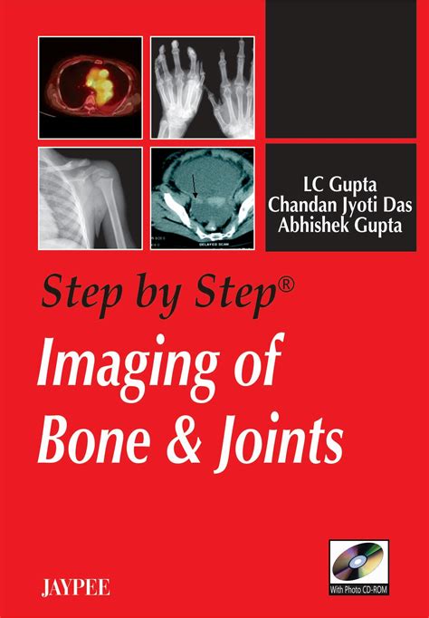 STEP BY STEP IMAGING OF BONE & JOINTS WITH PHOTO CD-ROM 1/E, 2008, LC ...