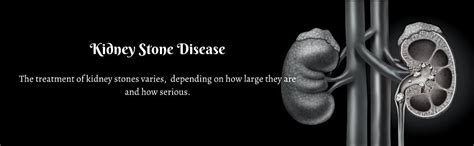 Kidney Stones Disease - How To Dissolve Kidney Stones Without Surgery ...