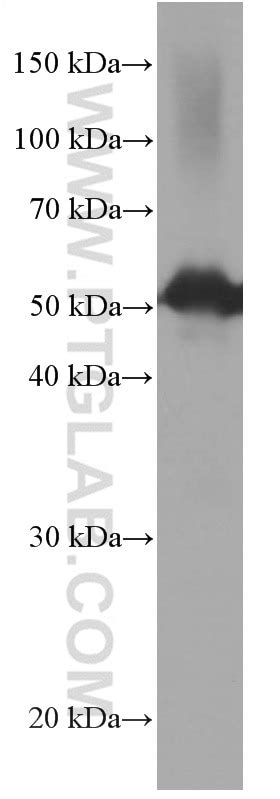 CDR2L antibody (66791-1-Ig) | Proteintech