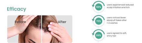 Buy Earth Rhythm Anti-Dandruff Shampoo Bar for Itchy & Flaky Scalp ...