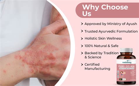 Vedabay Psoriasis Management Capsules, Approved by Ministry of Ayush ...