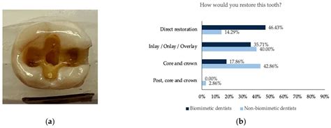 Decision Making in the Restoration of Endodontically Treated Teeth ...