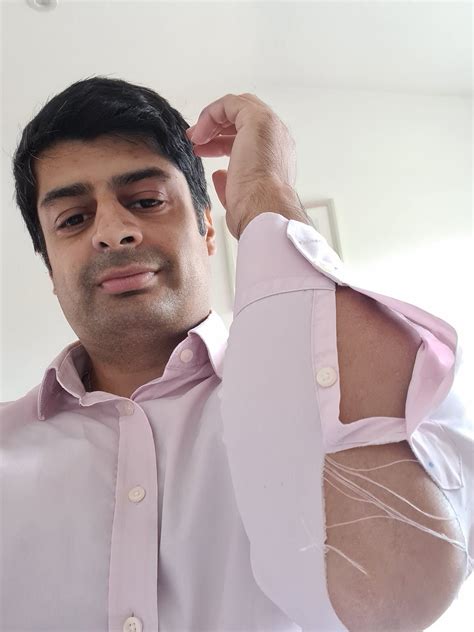 Shirt splitting forearms, the easy way | by Nasar Karim | Health Management
