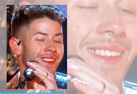 Nick trolled over 'spinach' in teeth while performing at Grammys, Watch ...
