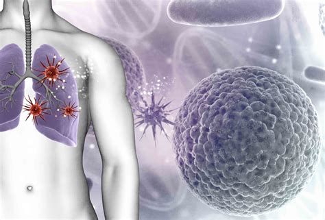 How Does Lung Cancer Affect Non-smokers? - Affinity Health