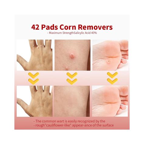 Reinreude Wart Corn Remover Pads for Feet: 42 Pack 40% India | Ubuy