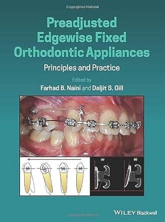 Buy Preadjusted Edgewise Fixed Orthodontic Appliances: Principles and ...