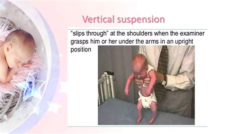 Approach to floppy infant | PPTX