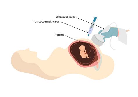 Prenatal Screening | Huntington's Victoria