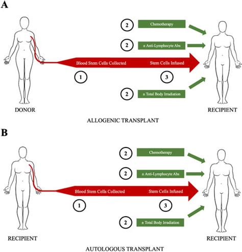 Hematopoietic Cell Transplantation for Systemic Sclerosis—A Review
