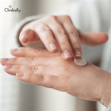 Lactic Acid Peels Benefits For Smoother Hands | Clinkally