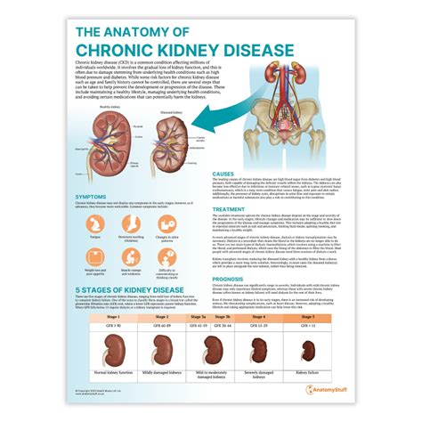 5 Stages Of Kidney Disease Chronic Kidney Disease And The Global