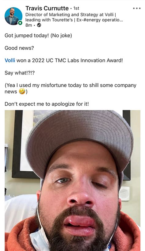 Cringe Be Like 的图像结果